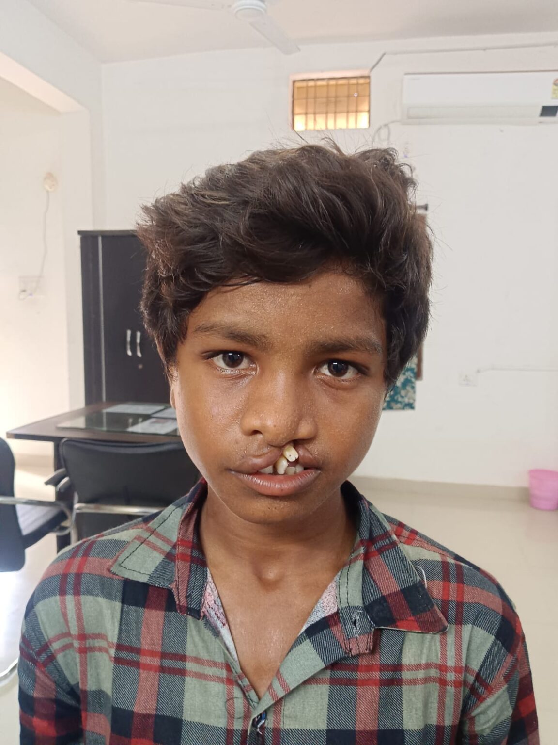 सफलता की कहानी : ‘चिरायु’ दल ने लौटाई मुस्कान, जन्मजात कटे होंठ और तालु से मिली मुक्ति राष्ट्रीय बाल स्वास्थ्य कार्यक्रम से 15 वर्षीय माड़कम हुंगा का हुआ निःशुल्क उपचार, परिवार को मिली बड़ी राहत।